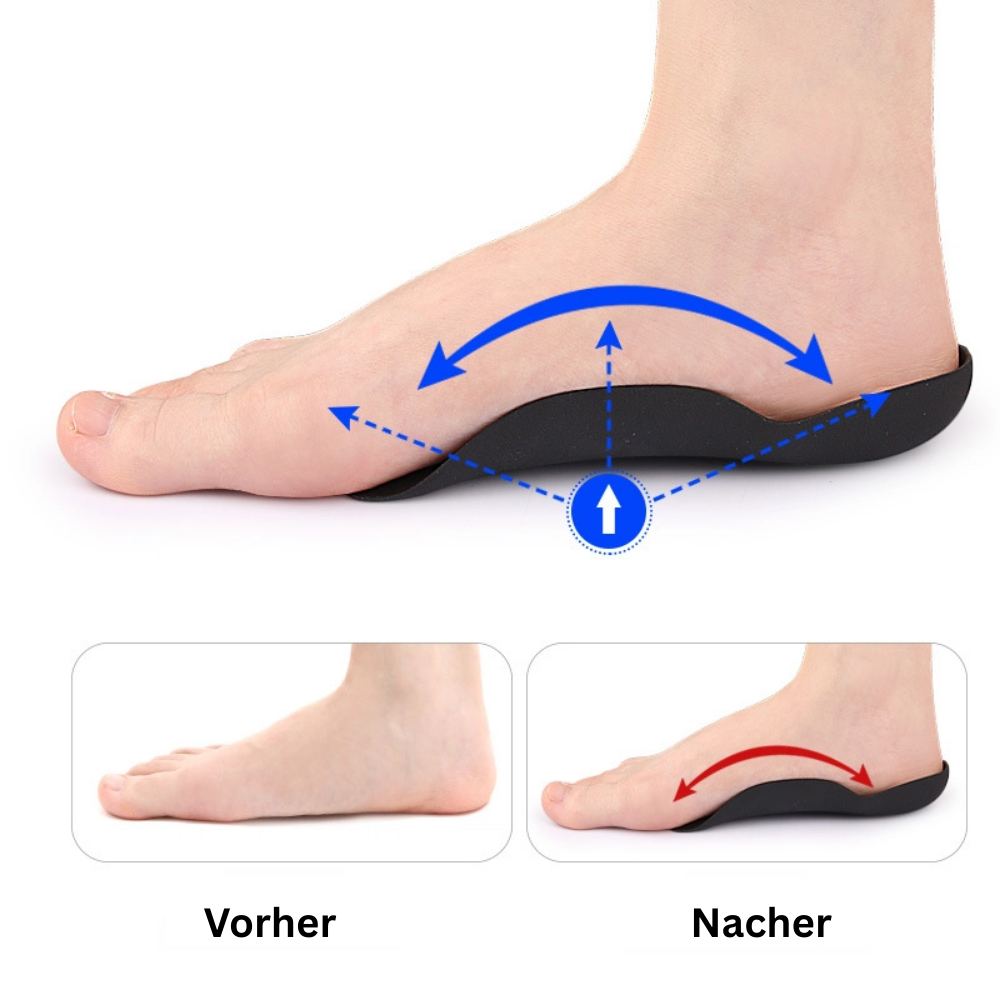 -35% Orthopädische Schuheinlagen ufoot