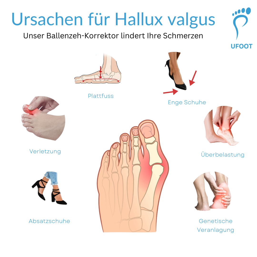 ufoot