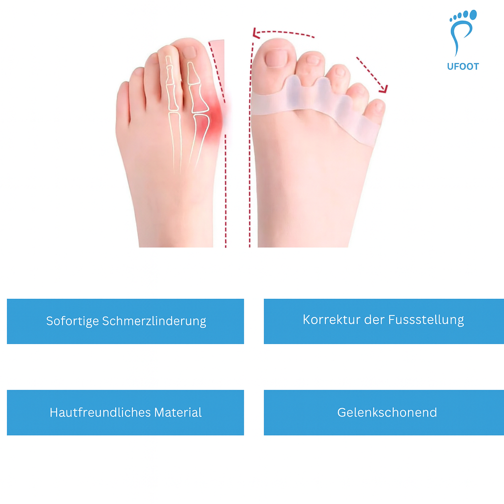 Zehentrenner SoftAlign ufoot