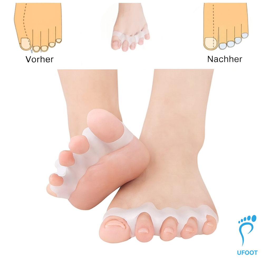 Zehentrenner SoftAlign ufoot