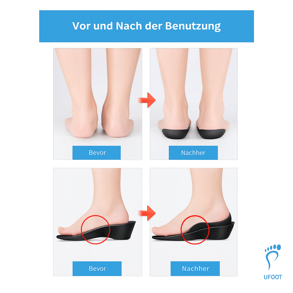 Orthopädische Schuheinlagen ufoot