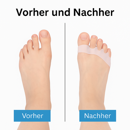 Zehentrenner SoftAlign ufoot